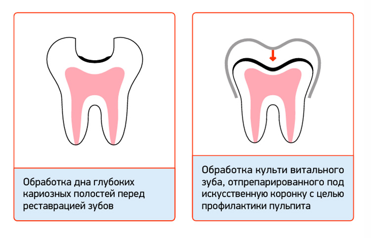 СМ_Флюор_пр04